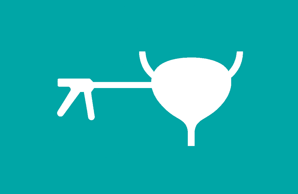 Αντιμετώπιση Διηθητικού Καρκίνου Ουροδόχου Κύστης. Άρθρο του Ουρολόγου Γιατρού Κοριτσιάδη Γεώργιου