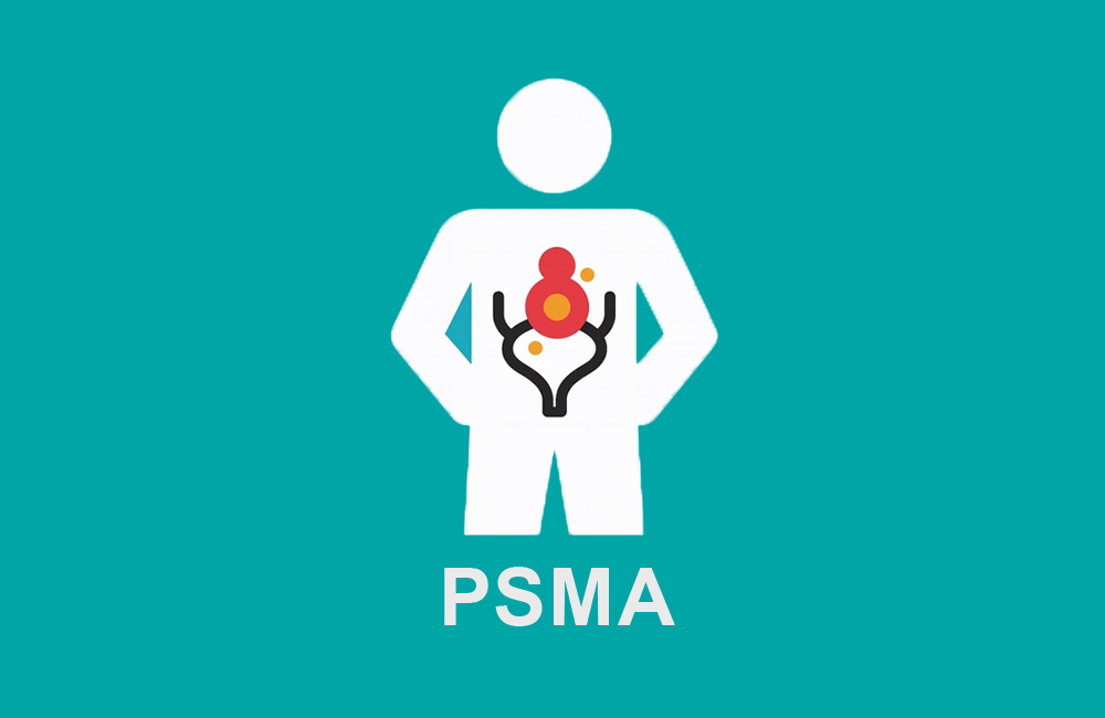 PSMA PET-CT / PET-MRI & Βιοψία Προστάτη. Άρθρο του Ουρολόγου Γιατρού Κοριτσιάδη Γεώργιου